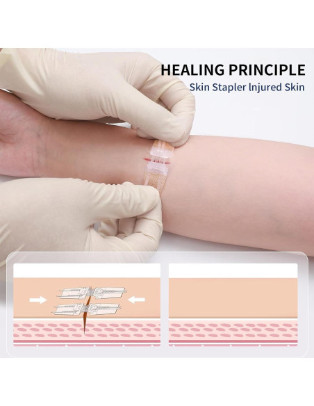 Cierre de Heridas de Emergencia URAY 4 Pcs Estériles