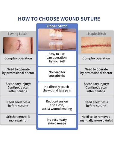 Cierre de Heridas de Emergencia URAY 4 Pcs Estériles