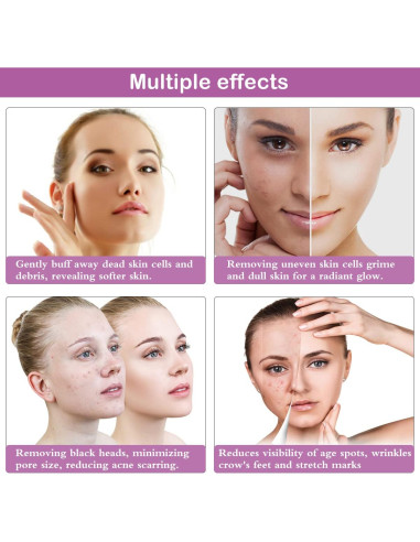 Máquina de Microdermoabrasión Yofuly, 17 Piezas, 65-68 cmHg