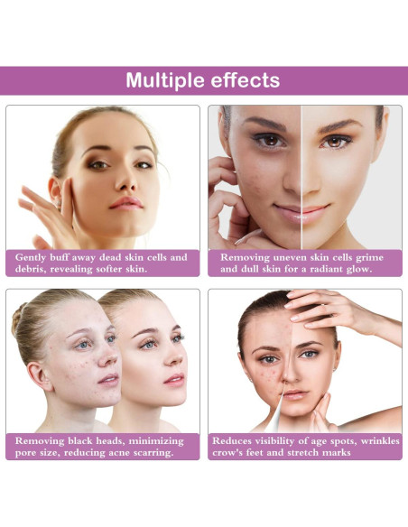 Máquina de Microdermoabrasión Yofuly, 17 Piezas, 65-68 cmHg