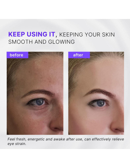 Aplicador de Crema para Ojos QooWo 2-en-1 con Rodillo de Hielo