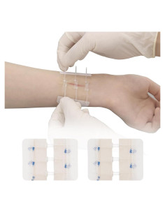 Dispositivo de Cierre de Heridas MaiWieel Sin Suturas 2 Piezas