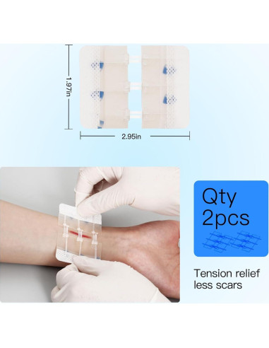 Dispositivo de Cierre de Heridas MaiWieel Sin Suturas 2 Piezas