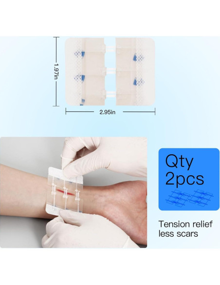 Dispositivo de Cierre de Heridas MaiWieel Sin Suturas 2 Piezas