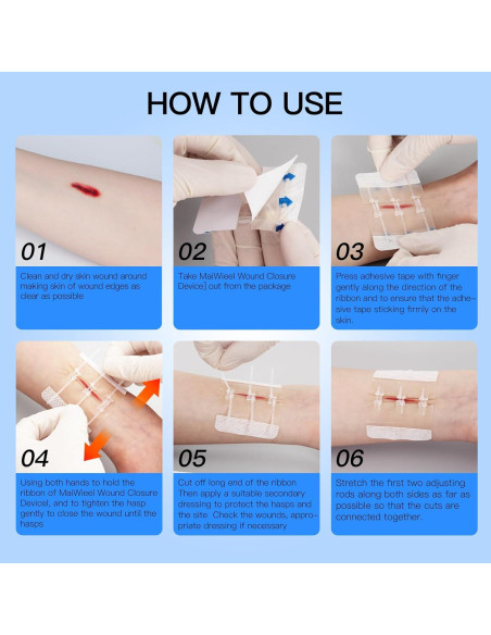 Dispositivo de Cierre de Heridas MaiWieel Sin Suturas 2 Piezas
