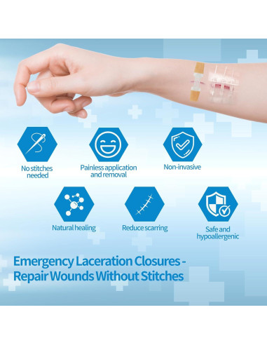 Kit de Cierre de Heridas Jointown - 2 Tiras, 4 Cierres