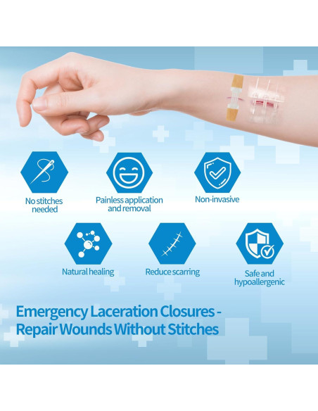 Kit de Cierre de Heridas Jointown - 2 Tiras, 4 Cierres