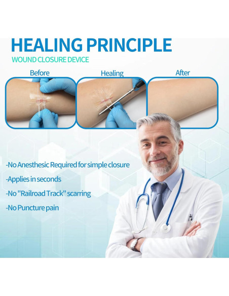 Kit de Cierre de Heridas Jointown - 2 Tiras, 4 Cierres