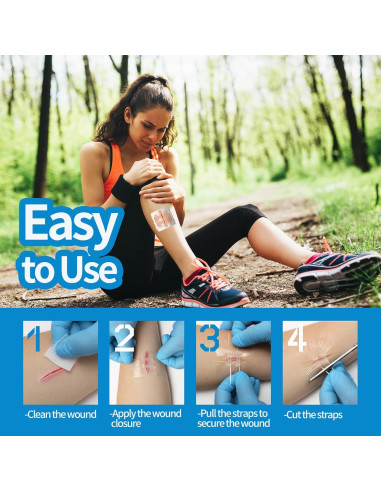 Kit de Cierre de Heridas Jointown - 2 Tiras, 4 Cierres