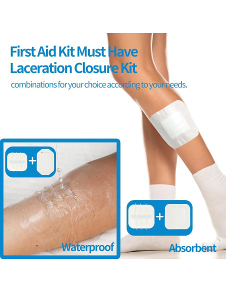 Kit de Cierre de Heridas Jointown - 2 Tiras, 4 Cierres