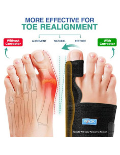Kit Corrector de Juanetes RFAQK - Alivio Hallux Valgus 11 Piezas 2