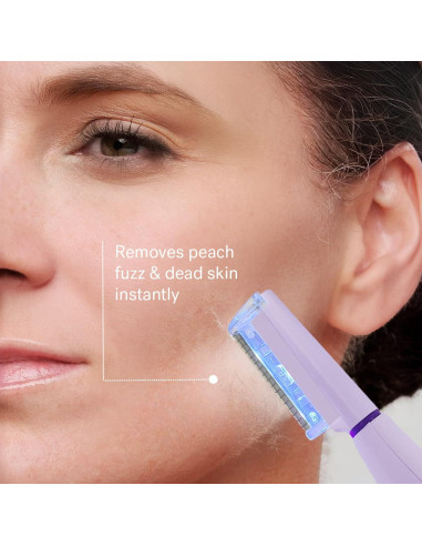 Sistema de Dermaplanado Michael Todd Beauty Sonicsmooth 340g