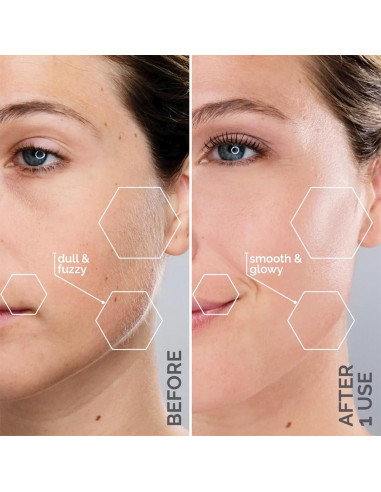 Sistema de Dermaplanado Michael Todd Beauty Sonicsmooth 340g