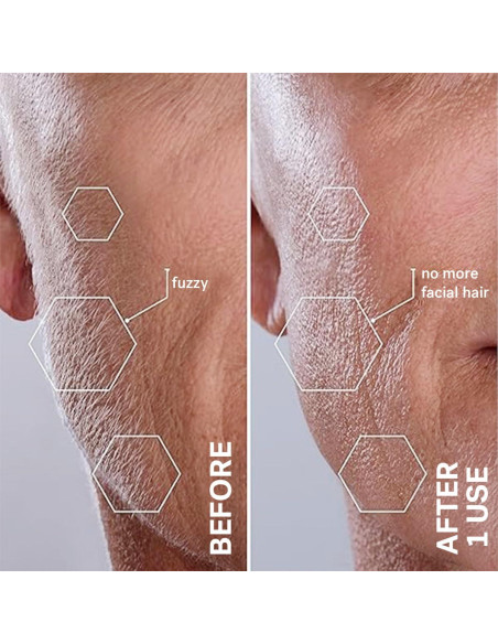 Sistema de Dermaplanado Michael Todd Beauty Sonicsmooth 340g