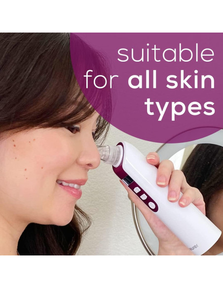 Removedor de Puntos Negros Beurer FC41 con 3 Cabezales y 5 Niveles