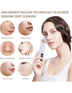 Aspiradora de Poros YUZYBH Limpiador Facial USB 3 Niveles 2
