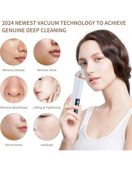 Aspiradora de Poros YUZYBH Limpiador Facial USB 3 Niveles