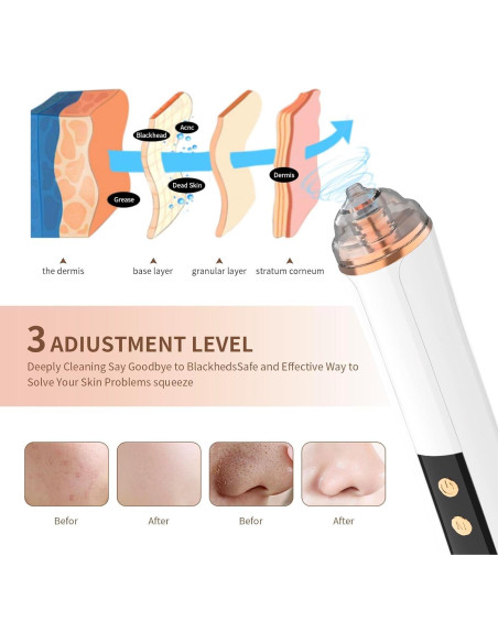 Aspiradora de Poros YUZYBH Limpiador Facial USB 3 Niveles