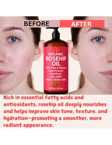 Aceite de Rosa Mosqueta Orgánico 473 ml - Puro y Prensado en Frío