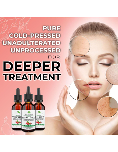 Aceite de Rosa Mosqueta Orgánico Jeune Naturelle 60 ml Puro