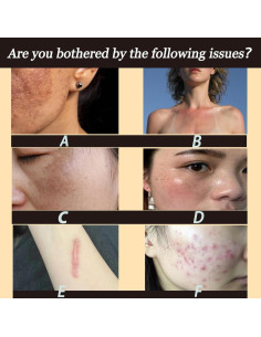 Juego de Cuidado Facial de Cúrcuma Wuliao - 2 Piezas 2