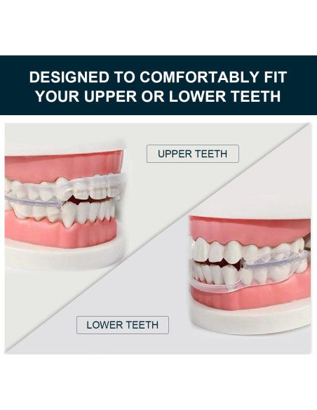 Protector Bucal Antirrechinado Wokyo - Paquete de 10 Unidades