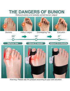 Corrector de Juanetes Ajustable Simpilos - 1 Par Negro 2