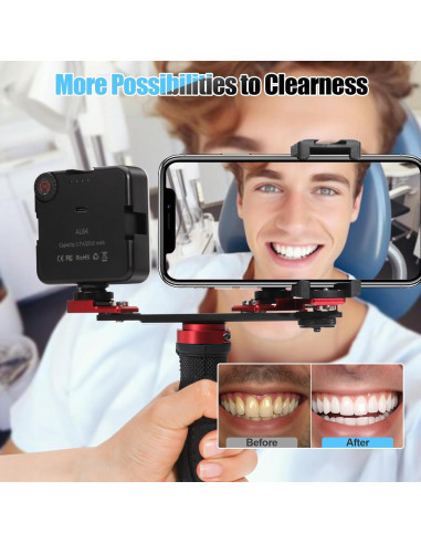 Luz de Relleno LED ANNWAH para Fotografía Dental y Móvil