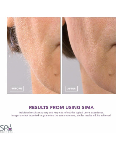 Afeitadora Dermaplane Spa Sciences SIMA - Exfoliación Facial Indolora 2-en-1