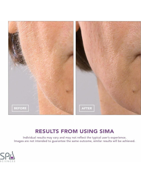 Afeitadora Dermaplane Spa Sciences SIMA - Exfoliación Facial Indolora 2-en-1