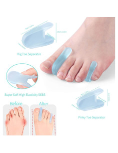 Corrector de Juanetes XREKNOi Blanco Pequeño para Alivio del Dolor 2