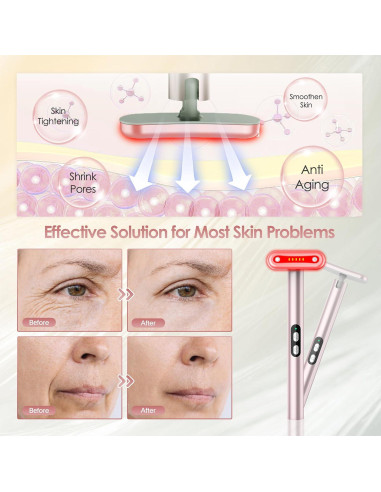 Masajeador Facial LED 7 Colores Shenzhen Ls-001 Rosa