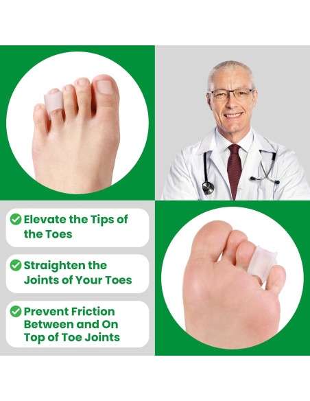 Corrector de Dedo en Garra Bukihome - 6 Paquetes Pequeños