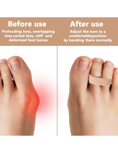 10 Férulas Buddy para Dedos Beige Reutilizables y Lavables