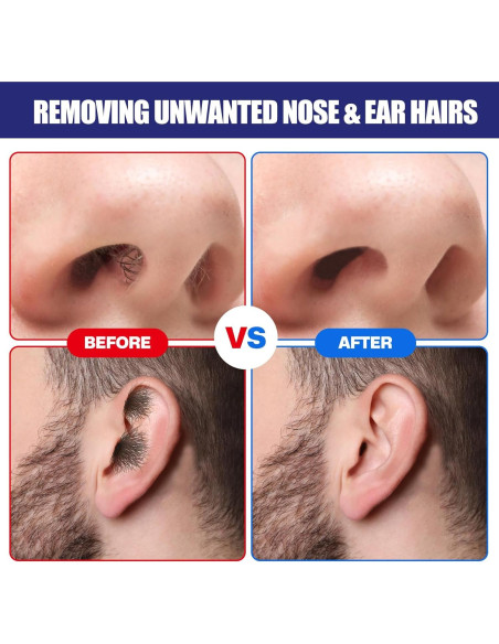 Kit de Cera para Nariz y Oídos Reni, 120 g, 30 Aplicadores