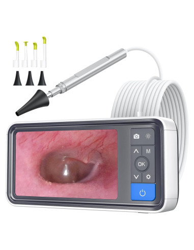 Otoscopio digital ScopeAround con pantalla IPS 4.5" y 32GB
