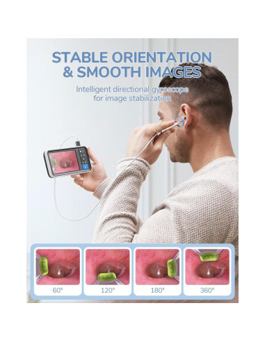 Otoscopio digital ScopeAround con pantalla IPS 4.5" y 32GB