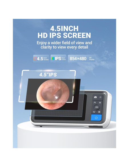 Otoscopio digital ScopeAround con pantalla IPS 4.5" y 32GB