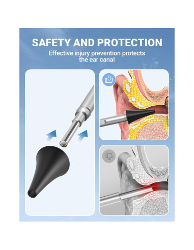 Otoscopio digital ScopeAround con pantalla IPS 4.5" y 32GB