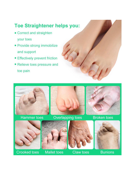 10 Piezas Correctores de Dedos en Martillo PDRODE Pequeño