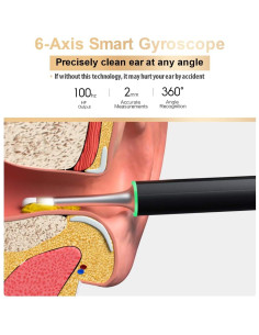 Cámara Endoscópica Bebird X17 Pro para Limpieza de Oídos 1080p 2