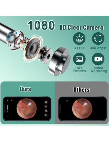 Otoscopio LMECHN con Cámara HD 1080P y 6 Luces LED