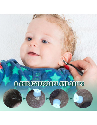 Otoscopio LMECHN con Cámara HD 1080P y 6 Luces LED