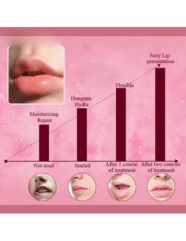 30 Mascarillas Labiales Hidratantes Felico - Colágeno Rosa y Fresa