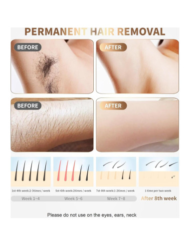 Depiladora Láser IPL Gransumr 999,999 Destellos Indolora