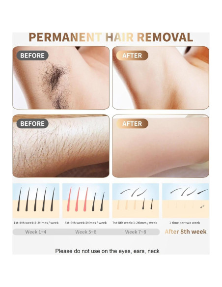 Depiladora Láser IPL Gransumr 999,999 Destellos Indolora