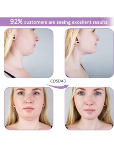 Reductor de Doble Papada COSDAD - Moldeador Facial Púrpura 2