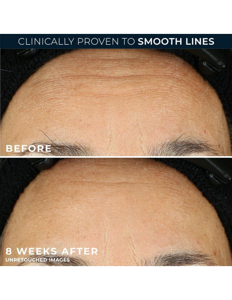 Suero Nocturno Anti-Envejecimiento RoC Retinol 30 Cápsulas 10.4 ml