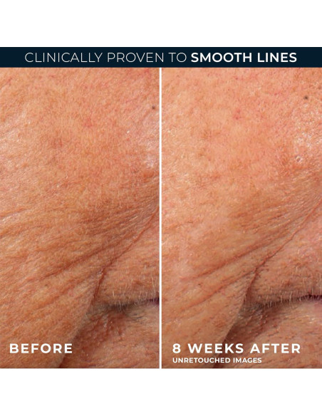 Suero Nocturno Anti-Envejecimiento RoC Retinol 30 Cápsulas 10.4 ml