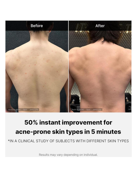 Medicube Lavado Corporal 414 ml - Limpiador Hidratante con Ácido Salicílico y Niacinamida